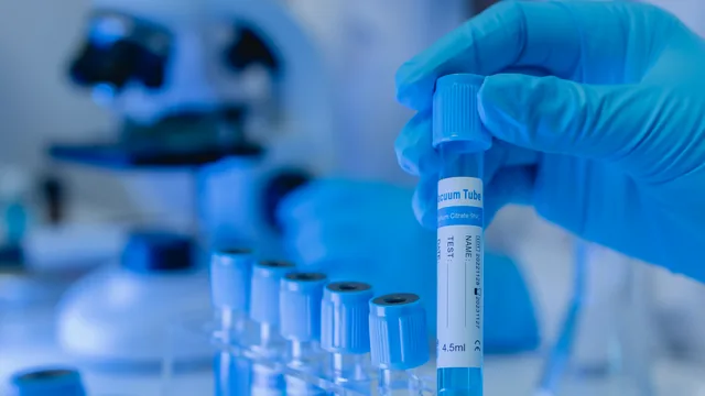 Bioquímica del Laboratorio LVV preparando tubos de muestras de sangre en Bahía Blanca